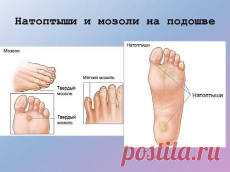 Одноклассники