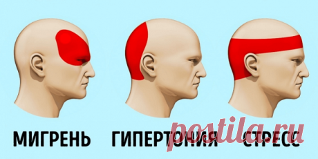 Как избавиться от головной боли без таблеток за 5 минут ! Подтверждено научными исследованиями
