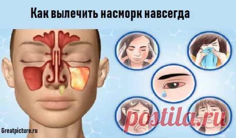 Как вылечить насморк
Как вылечить насморк навсегда:
Симптомы простуды преследуют нас практически в любой сезон. Самый неприятный и назойливый из них – насморк.Медицина в настоящее время предлагает массу эффективных сре…