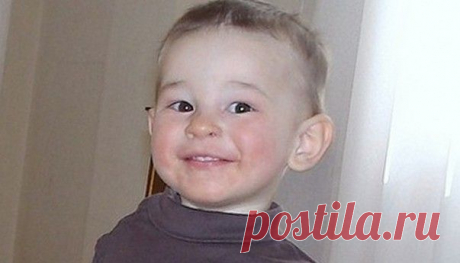 Атипичный дерматит у детей и взрослых: фото