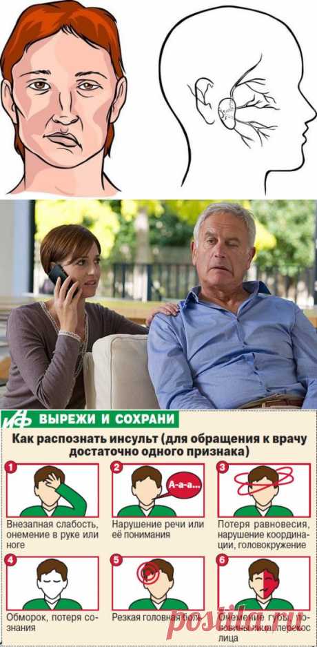 Первые признаки инсульта