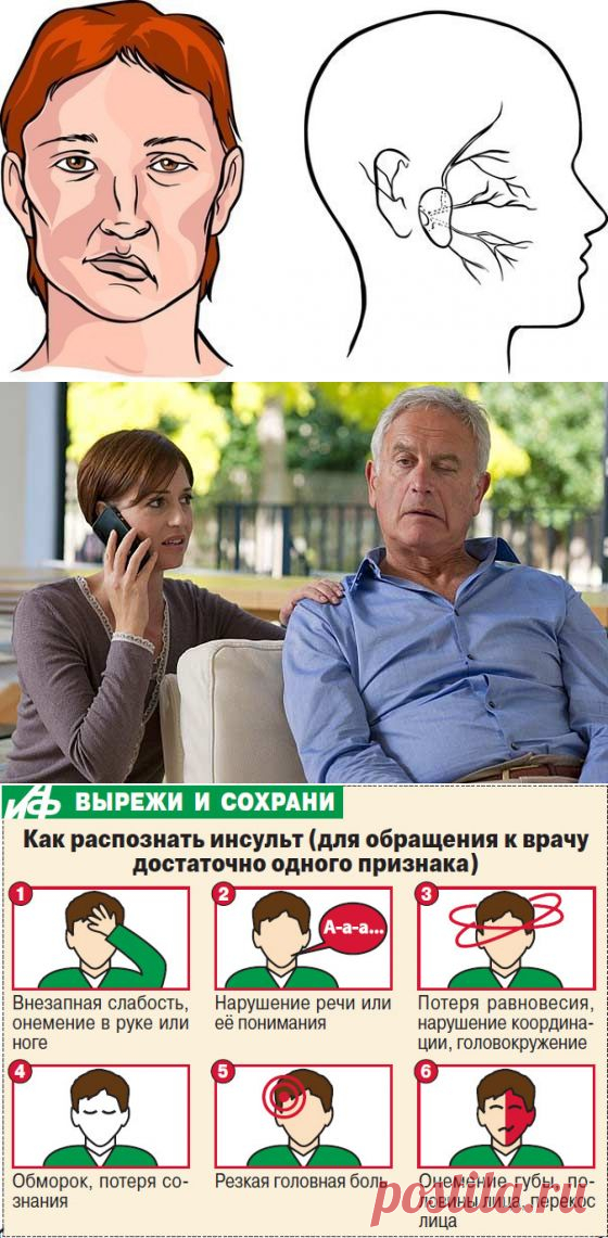 Первые признаки инсульта