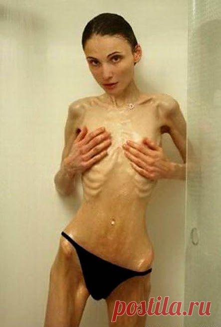 Задумайтесь о будущем! | Друг пенсионера
Быть может, кого-то моя история убе­режет от страшной ошибки, которую я совершила.

Сейчас все чаще и чаще можно услышать о такой болезни, как анорексия.