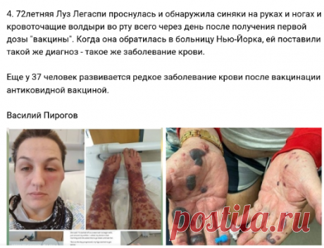 "И СДЕЛАЛИСЬ ЖЕСТОКИЕ И ОТВРАТИТЕЛЬНЫЕ ГНОЙНЫЕ.. | КОЛХОЗ - ДЕЛО ДОБРОВОЛЬНОЕ!