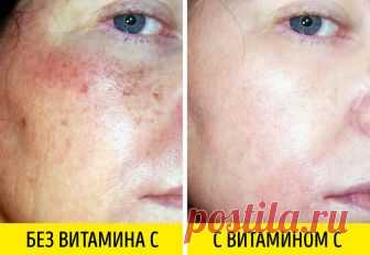 Мощное антивозрастное действие - 3 препарата, которые борются с морщинами не хуже «уколов красоты» Пластика, ботокс, «уколы красоты» — на что только не пойдешь ради сохранения и поддержания молодости. А тем, кто не готов к подобным мерам, мир предоставил на выбор внушительный арсенал омолаживающих косметических средств...