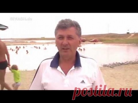 Псориатический артрит - симптомы и фото. Псориатический артрит без псориаза