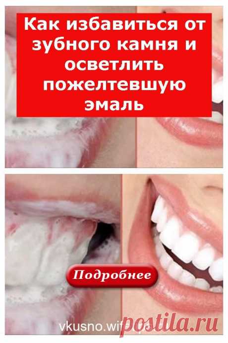 Как избавиться от зубного камня и осветлить пожелтевшую эмаль - vkusno