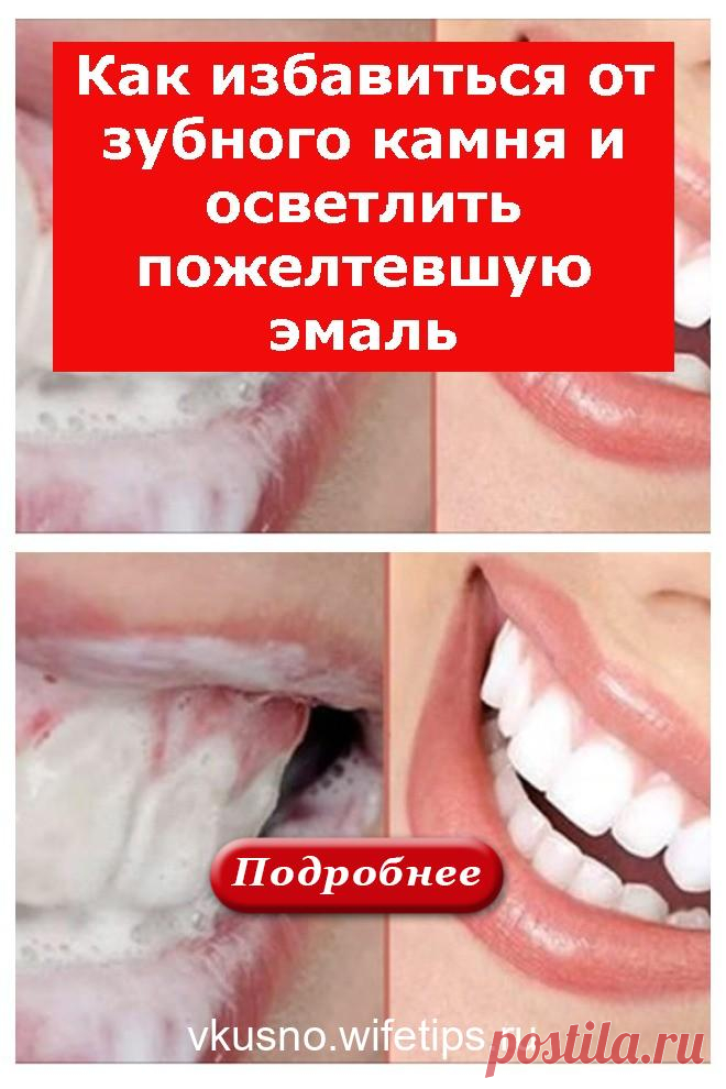 Как избавиться от зубного камня и осветлить пожелтевшую эмаль - vkusno