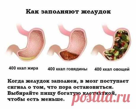Мой выбор!