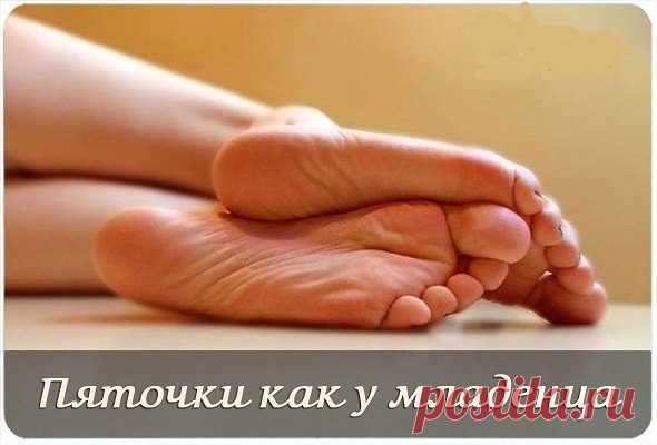 (33) Одноклассники