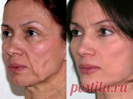 Убрать брыли и носогубки упражнением «лифт»: минута в день для омоложения и подтяжки