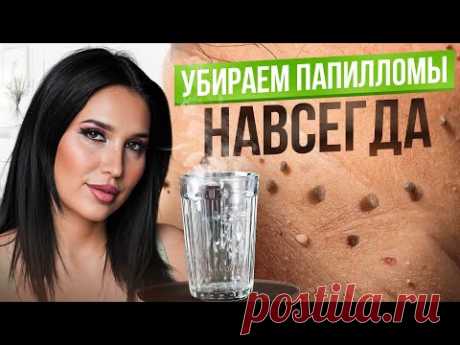 3 простых способа избавиться от папиллом в домашних условиях