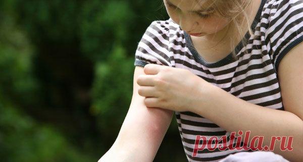 Как защитить ребенка от комаров: безопасные рецепты