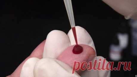 Почему кровь на анализ берут из безымянного пальца? | Будьте здоровы!