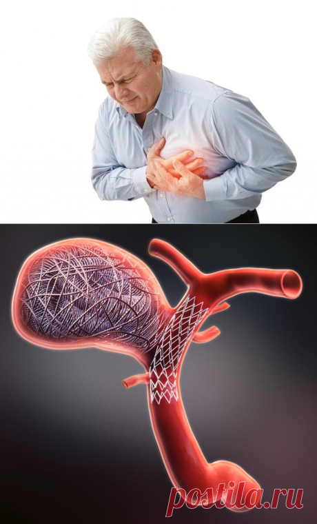 Болит сердце, немеет левая рука: что делать