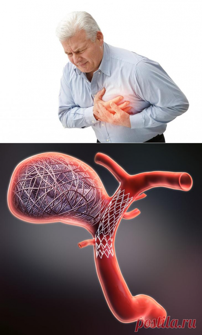 Болит сердце, немеет левая рука: что делать