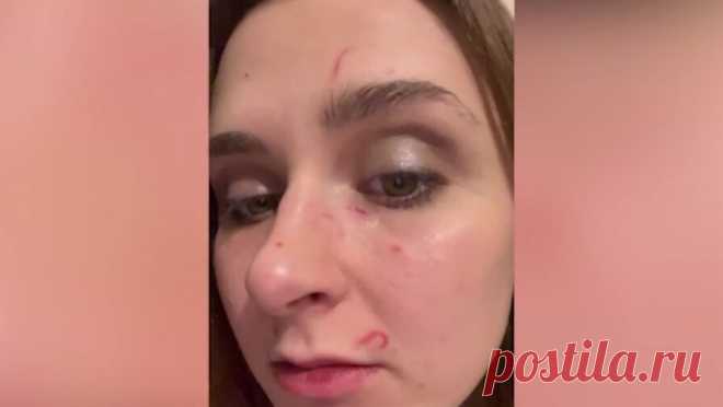 Детский аниматор обвинила недоплатившую клиентку в нападении. В Москве аниматор обвинила клиентку-предпринимательницу в нападении из-за денежного спора. Об этом сообщает Life со ссылкой на Telegram-канал "Shot Проверка". По информации Telegram-канала, инцидент произошел после праздника в ...