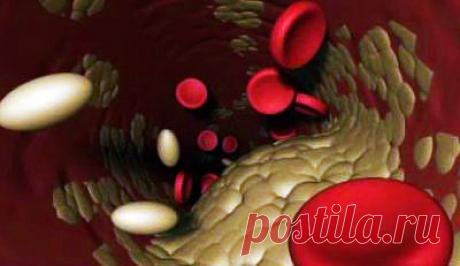 Все про холестерин: норма в крови, как снизить, советы и рекомендации