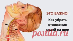 Убираем отложения солей на шее