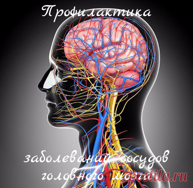 Профилактика заболеваний сосудов головного мозга