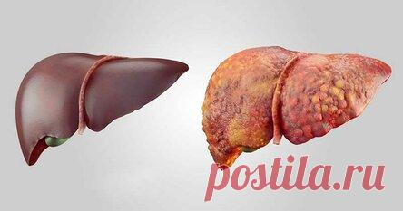 Шесть признаков, которые предупреждают о том, что печень делает вас полными, потому что они наполнена токсинами