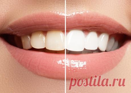 Как отбелить желтые зубы естественным способом в домашних условиях всего за 2 минуты Вы будете удивлены! В этой статье мы узнаем, как отбелить желтые зубы естественным способом. Улыбка может залечить много ран, и это правда. Чистая и