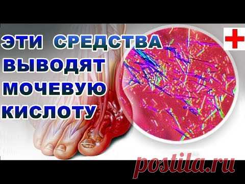 КАК СНИЗИТЬ УРОВЕНЬ МОЧЕВОЙ КИСЛОТЫ НАРОДНЫМИ СРЕДСТВАМИ В ОРГАНИЗМЕ. КАКИЕ ПРОДУКТЫ НЕЛЬЗЯ ЕСТЬ!