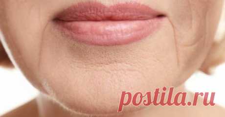 коррекции марионеточных морщин в Киеве - Coolaser Clinic