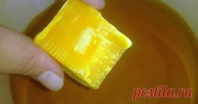 Чудодейственная мазь. Сохраните себе и используйте, если вас настигла болезнь Эта мазь лечит много болезней: фибромы, мастит, гангрена, язвы (в том числе и трофические), ожоги, чирьи, нарывы, больные суставы, самые застарелые гаймориты, гнойные отиты, нарывы в горле, экзема, кисты яичников — все это вылечит чудо- мазь! В эмалированную посуду влить 1 стакан рафинированного...