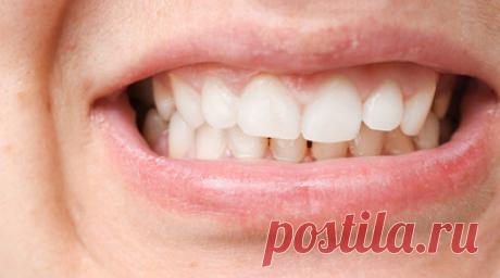 Стоматолог Дмитрова: на исправление прикуса у взрослых может потребоваться три года. Главный врач стоматологического отделения АО «Медицина» (клиника академика Ройтберга) д. м. н. Алина Дмитрова рассказала, что исправление прикуса у взрослого человека может занять до трёх лет. Читать далее