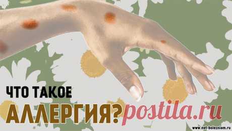 Что такое аллергия, её виды и как она возникает? 

Часто можно услышать о том, что у кого-то есть аллергия на то или на другое.

Действительно, аллергия - очень распространенное явление, которое является анормальной реакцией на какой-нибудь фактор.