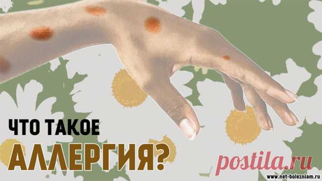 Что такое аллергия, её виды и как она возникает? 

Часто можно услышать о том, что у кого-то есть аллергия на то или на другое.

Действительно, аллергия - очень распространенное явление, которое является анормальной реакцией на какой-нибудь фактор.