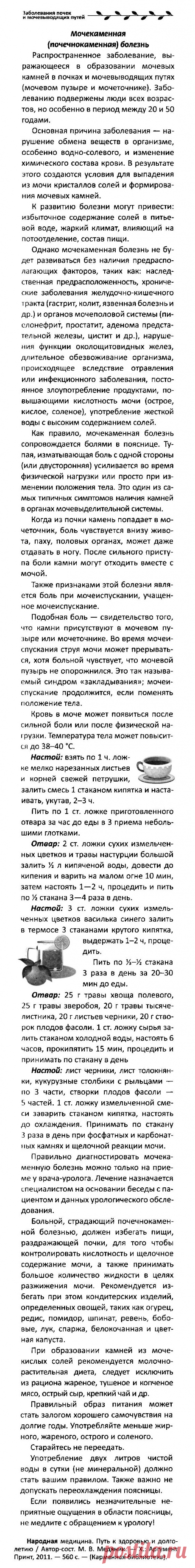 Мочекаменная (почечнокаменная) болезнь