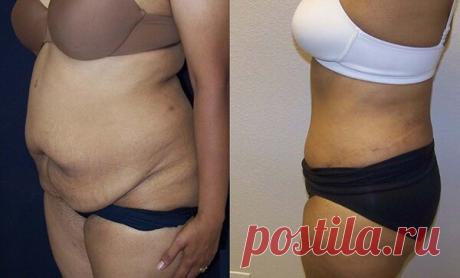 Я внедрила одну полезную привычку и скинула 17 кг за 1 месяц + убрала жир на животе

Часто слышу от женщин фразу: «Я ничего не ем, а толстею». Раньше я верила в это, да и сама порой про себя так думала. Теперь, никто меня в этом не убедит. Как говорила Майя Плисецкая: «Не жрать! Более действенного способа еще не придумали». Звучит жестоко, но это так – проверила на себе.