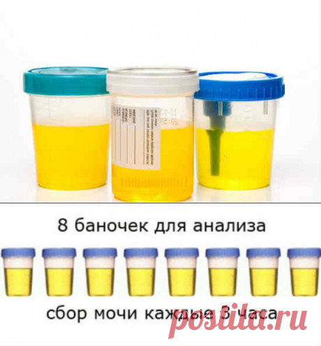 Анализ мочи по Зимницкому: что показывает, расшифровка