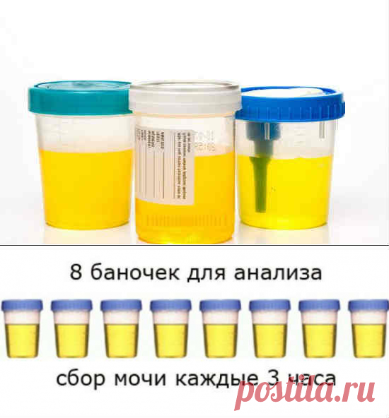 Анализ мочи по Зимницкому: что показывает, расшифровка