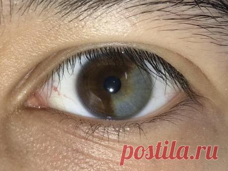 25 необычных людей, от которых захватывает дух
Говорят, что в каждом человеке есть что-то уникальное, но, глядя на некоторых, невольно думаешь, что у них есть цельный, уникальный пакет. Интернет-пользователи не постеснялись рассказывать нам об этих необычных особенностях своей внешности, и они действительно впечатляют. Я собрал для вас 25 фотографий людей, от которых невозможно оторвать глаз. А в конце вы получите бонус, доказывающий, […]
Читай дальше на сайте. Жми подробнее ➡