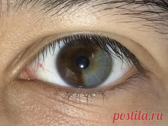 25 необычных людей, от которых захватывает дух
Говорят, что в каждом человеке есть что-то уникальное, но, глядя на некоторых, невольно думаешь, что у них есть цельный, уникальный пакет. Интернет-пользователи не постеснялись рассказывать нам об этих необычных особенностях своей внешности, и они действительно впечатляют. Я собрал для вас 25 фотографий людей, от которых невозможно оторвать глаз. А в конце вы получите бонус, доказывающий, […]
Читай дальше на сайте. Жми подробнее ➡