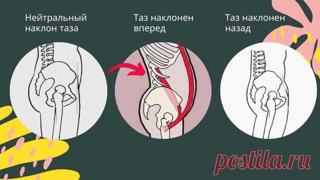 Как гиперлордоз, передний наклон таза, затягивает ткани лица вниз. Упражнение от болей в пояснице
Передний наклон таза Передний наклон таза Передний наклон таза — это когда таз наклонен вперед. Эта одна из наиболее часто встречающихся проблем у женщин, мужчин и даже детей. При переднем наклоне таза появляется чрезмерный прогиб в пояснице, а спереди вываливается живот, который не убирается...
Читай дальше на сайте. Жми подробнее ➡