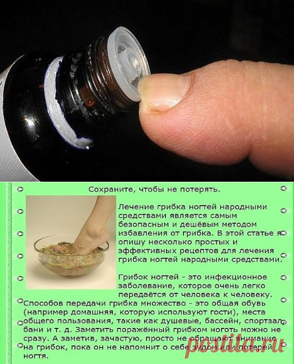 Народные средства от грибка ногтей. Народное средство от грибка на ногах. Средство от грибка ногтей на ногах. Народные средства лечения грибка ногтей отзывы. Средство от грибка ногтей эффективное.