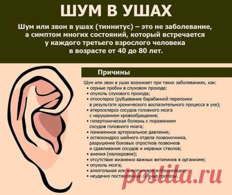 Топ-10 самых лучших препаратов от шума в ушах