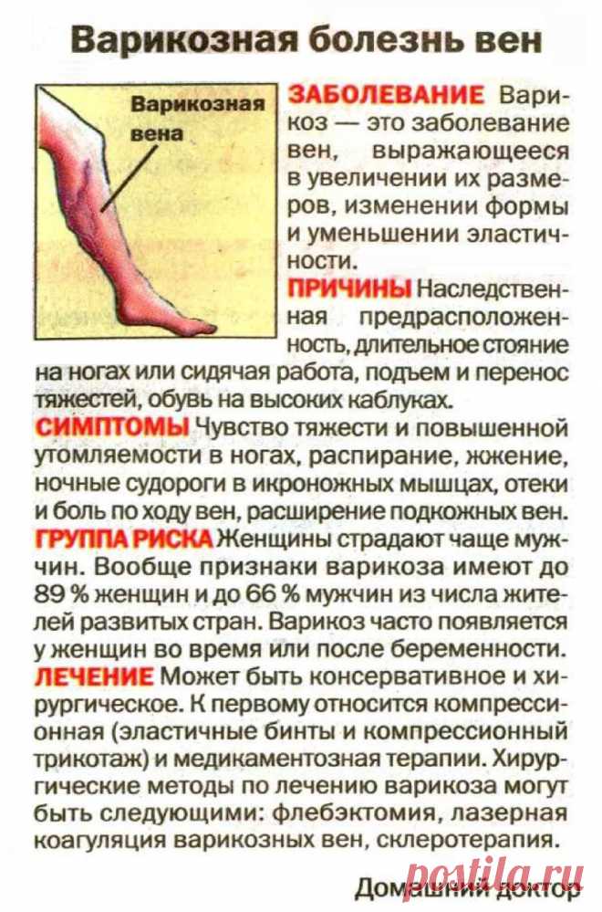 Варикозная болезнь вен
