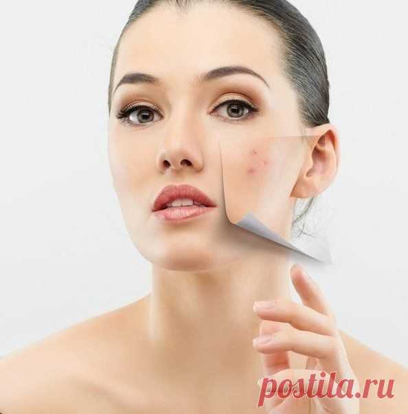 Как избавиться от пятен после прыщей.
