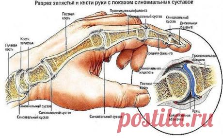 (23) Одноклассники