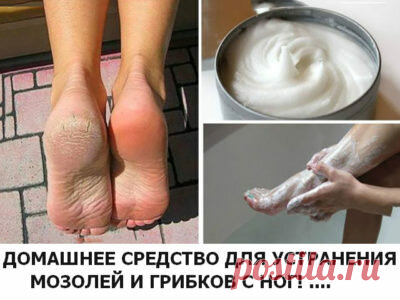СРЕДСТВО ДЛЯ УСТРАНЕНИЯ МОЗОЛЕЙ И ГРИБКОВ С НОГ!