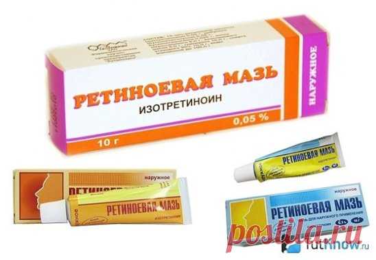 Купила в аптеке за три копейки. Я в шоке. Морщины на лбу разгладились!!!!!! Девочки, не нужно дорогостоящих кремов - с морщинами с успехом борются аптечные мази от морщин. Вот подборка лучших средств из аптеки: Ретиноевая мазь от морщин. Ретинол (витамин А) считается главным «врагом» старости, ведь именно благодаря нему происходит регенерация клеток. Ретиноевая мазь от морщин увеличивает выработку коллагена, улучшает состояние кожи, разглаживает морщины. Рекомендуется использовать препарат следу
