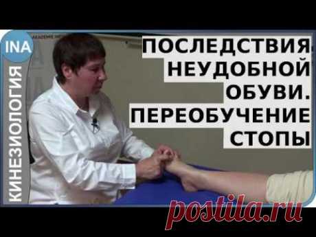 Последствия неудобной обуви. Переобучение стопы. Кинезиология. Германия
