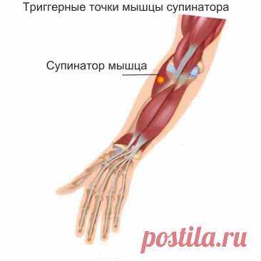 Cупинатор мышца. Самомассаж