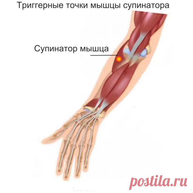 Cупинатор мышца. Самомассаж