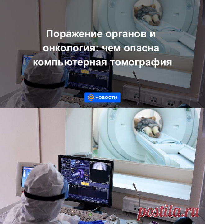 Поражение органов и онкология: чем опасна компьютерная томография - Новости Mail.ru